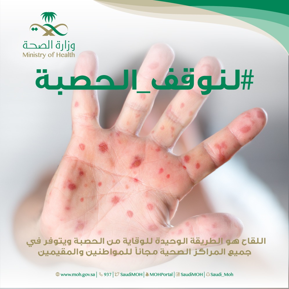 الصحة تطلق الحملة الوطنية للتطعيم ضد الحصبة