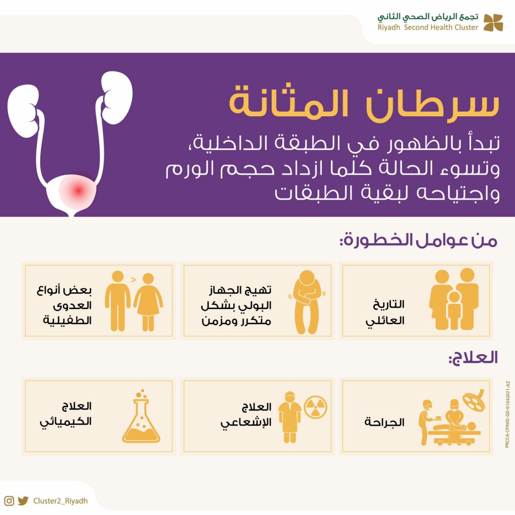 تجمع الرياض 2: يوضح كيف ينتشر سرطان المثانة وعوامل الخطورة وطرق علاجه