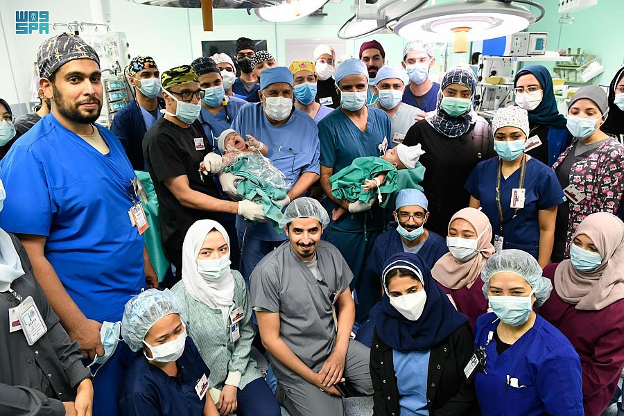 الفريق الطبي السعودي ينجح في فصل التوأم السيامي اليمني (مودة ورحمه)